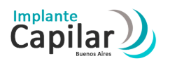 Implante Capilar Buenos Aires